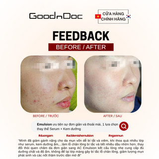GoodnDoc AC Control Blemish Emulsion – Cung Cấp Dưỡng Chất Cho Da, Dưỡng Da Mềm Mịn, Giảm Thâm Mụn