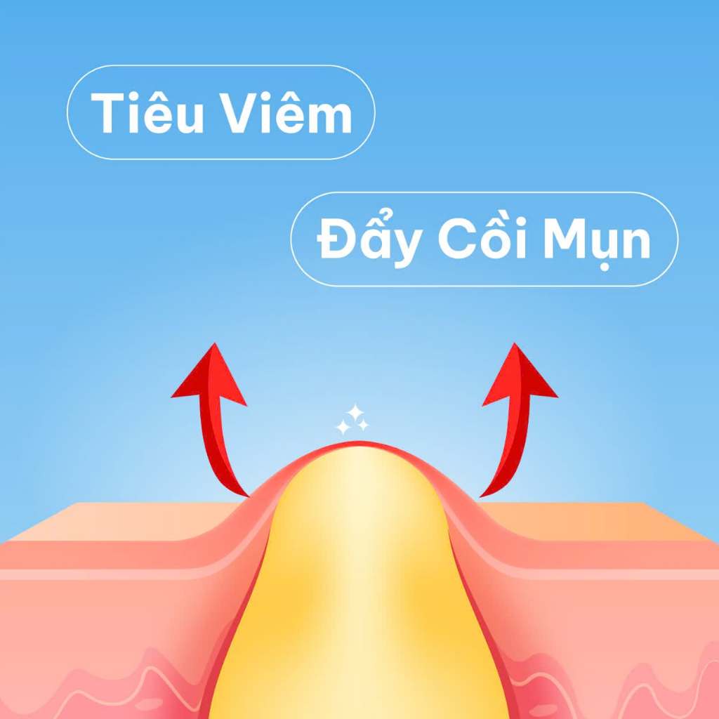 Gel Chấm Giảm Mụn Nhanh Trong 7 Ngày DERMATIDEM PLUS 20g Giúp Giảm Viêm Mờ Thâm Mụn Gel Mụn | BigBuy360 - bigbuy360.vn