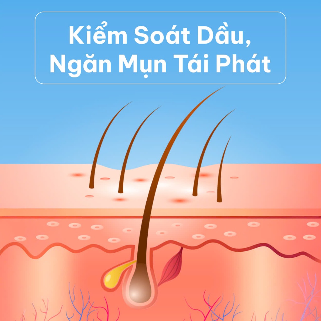 Gel Chấm Giảm Mụn Nhanh Trong 7 Ngày DERMATIDEM PLUS 20g Giúp Giảm Viêm Mờ Thâm Mụn Gel Mụn | BigBuy360 - bigbuy360.vn