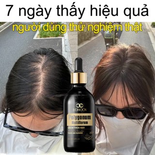  thuốc mọc tóc serum Giảm rụng tóc bảo vệ chân tóc kích thích mọc tóc nuôi dưỡng tóc hư tổn giúp tóc đen trở lại 50ml 