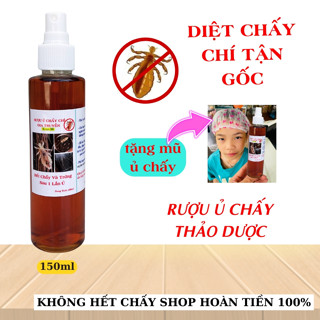  Rượu ủ chấy chí dầu gội chấy hết chấy và trứng chấy sau 1 lần ủ chai 150ml 