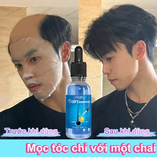 Mọc tóc mới trong 7 ngày thuốc kích mọc tóc nhanh thuốc mọc tóc thuốc mọc tóc nhanh cho nam kích mọc tóc nhật bản