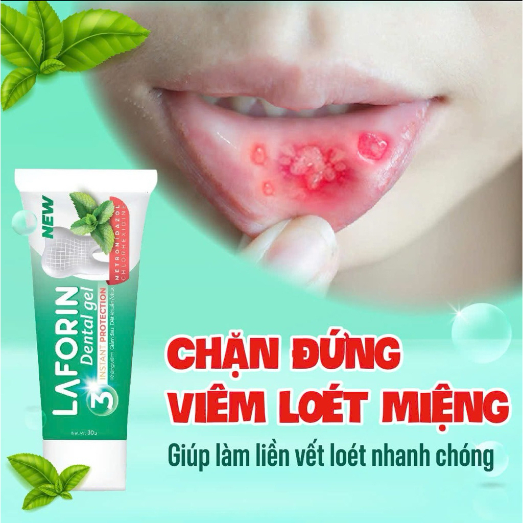 Gel bôi nhiệt miệng Laforin dental gel tuýp 20gr