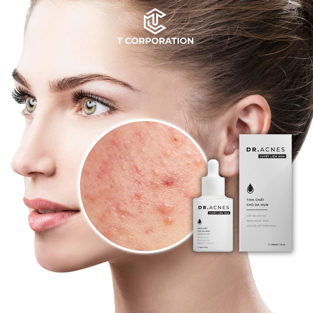 [DAEL MỞ BÁN] Serum Chấm Mụn DR.ACNES Tuyết Liên Hoa, se cồi mụn, giảm viêm, giảm thâm, 30ml