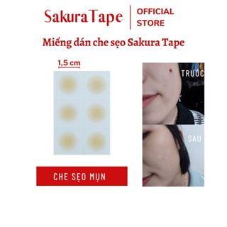  Miếng dán che sẹo mụn nốt ruồi SakuraTape đường kính 1.5cm mỏng nhẹ chống nước 