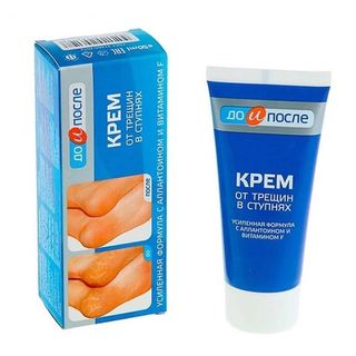 Kem nứt gót chân Nga Kpem giúp vùng da gót chân luôn mềm mại