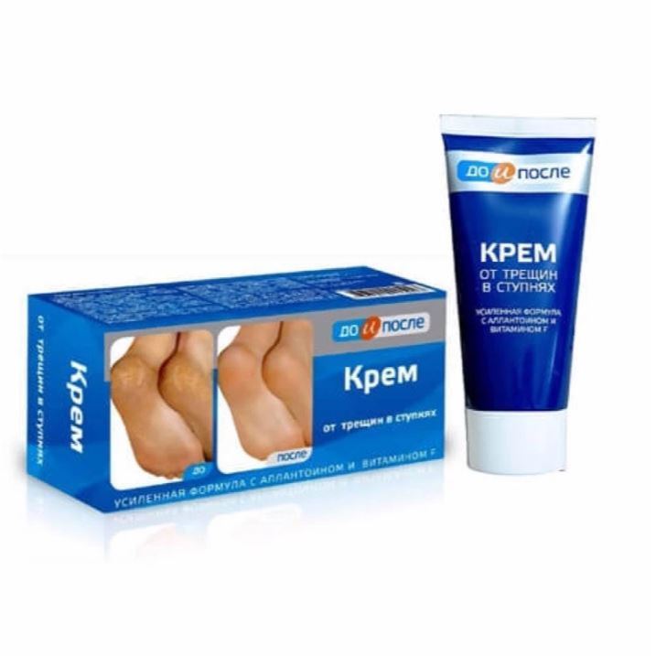 Kem dưỡng ẩm KPEM chống nứt nẻ gót chân Before and After 50ml