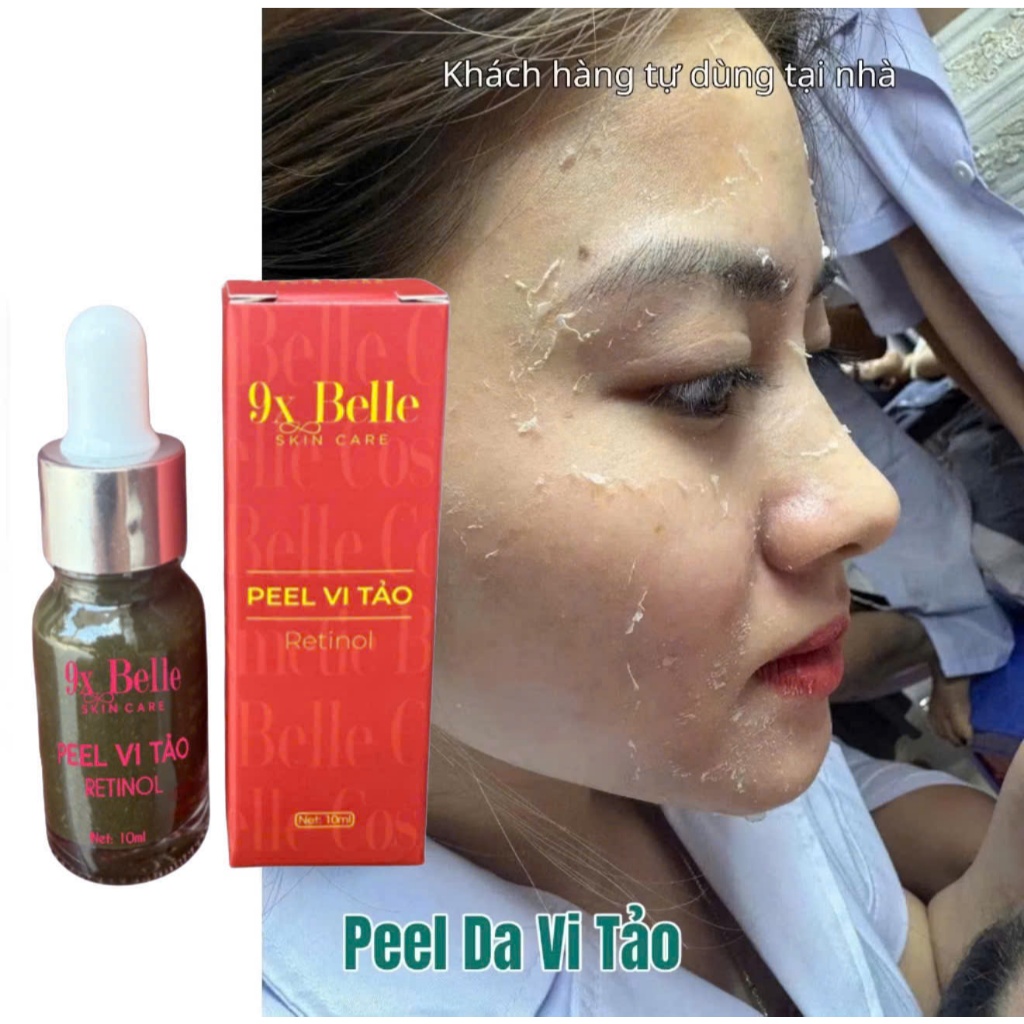  PEEL DA MẶT VI TẢO CAO CẤP tẩy da chết giảm mụn thâm nám tàn nhang thay da sinh học peel lột da retinol  mẫu mới  