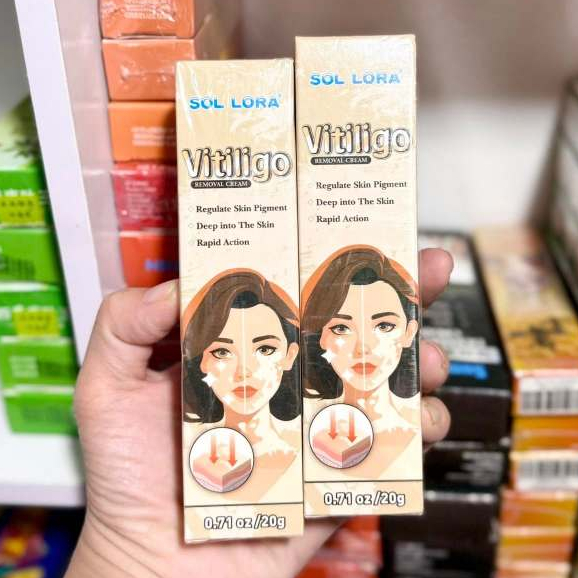 Kem Bôi Lang Ben Đốm Trắng Sol Lora - Kem Sol Lora Thảo Dược Bôi Đốm Trắng Bạch Biến Đốm Trắng