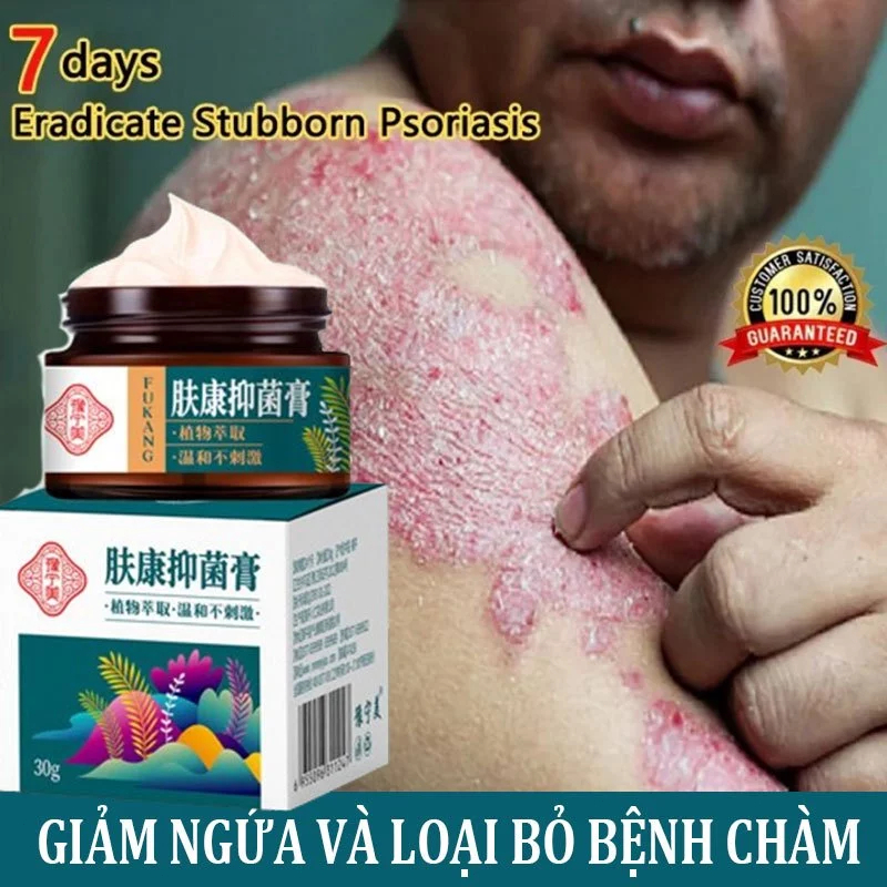 kem bôi nấm ngứa kem bôi ngoài da ghẻ ngứa Kem chống ngứa 30g kem bôi chàm Kem bôi vảy nến