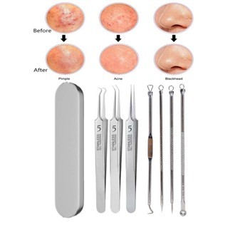  Bộ nặn mụn 8 món cao cấp - Dụng cụ lấy nhân mụn chuyên nghiệp nhíp gắp mụn chuẩn Spa chất liệu thép không gỉ Berrybell 