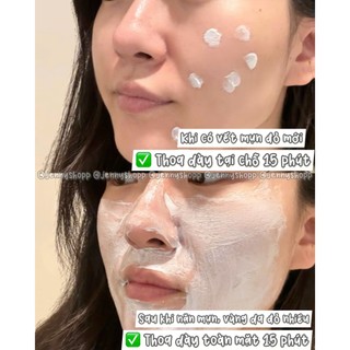 Kem Dưỡng Phục Hồi Da La Roche-Posay B5