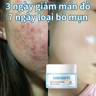 kem mụn cao mụn thảo mộc kem mụn acnes hết mụn axit azelaic axit salicylic loại bỏ mụn nhanh chóng làm mịn da 30g