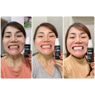 Xịt thơm miệng MEXI Quyên lara