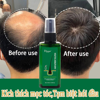 xịt mọc tóc serum mọc tóc kích mọc tóc 120ml Nuôi dưỡng da đầu hiệu quả để tóc mọc và chăm sóc  phù hợp cho cả nam và nữ