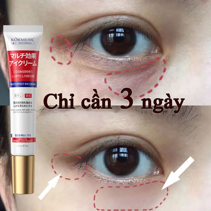 Kem mắt phục hồi đa công dụng nhật bản Quầng thâm + bọng mắt + nếp nhăn 3 tầng chống lão hóa 20g 30 ngày mờ nhăn