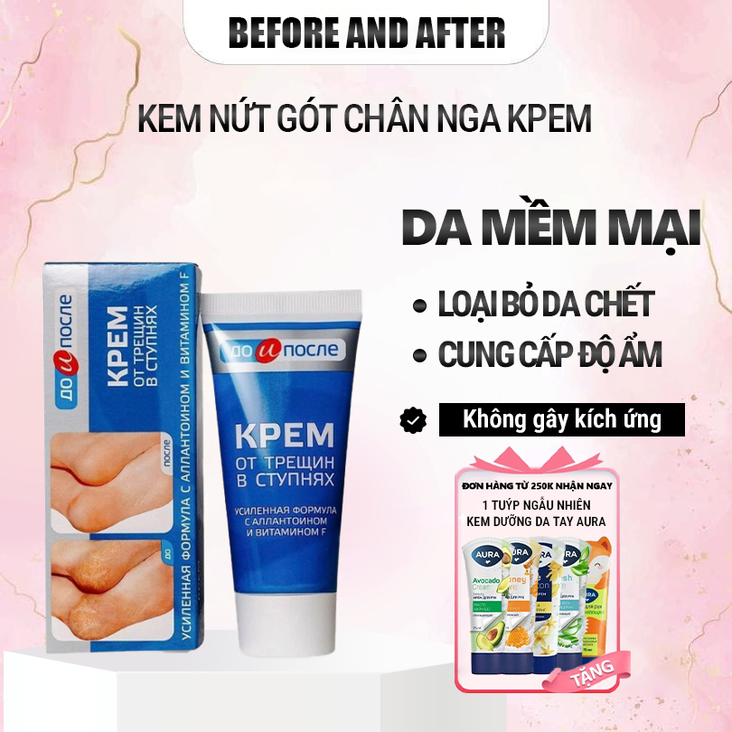 Kem nứt gót chân Nga Kpem giúp vùng da gót chân luôn mềm mại