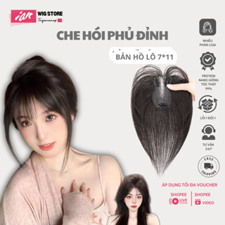 Tóc Giả Phủ Hói iAn Hồ Lô 3 Kẹp Mái Bay, Mái Thưa