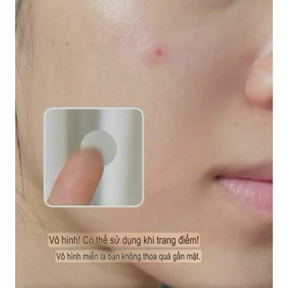 Miếng dán mụn DermSmile siêu mỏng 0.2mm – 96 miếng (10mm & 12mm)