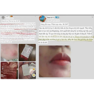 Miếng dán mụn DermSmile siêu mỏng 0.2mm – 96 miếng (10mm & 12mm)
