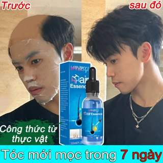  Mọc tóc mới trong 7 ngày thuốc kích mọc tóc nhanh thuốc mọc tóc thuốc mọc tóc nhanh cho nam kích mọc tóc nhật bản 