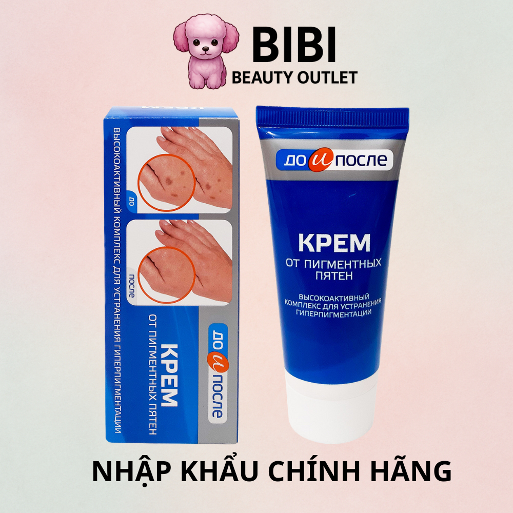 Kem Dưỡng Mờ Đồi Mồi, Nám, Sạm, Đốm Nâu Kpem Before & After Chính Hãng Nga Tuýp 50g