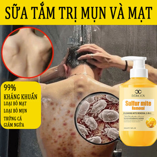  Sữa tắm mụn lưng Sữa tắm chống ve 500g Giúp kiểm soát tiết dầu Làm sạch sâu Giảm mụn trứng cá  Làm trắng da+1 