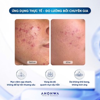 Tinh Chất Chấm Mụn Ahohwa Control Clear Spot 30ml