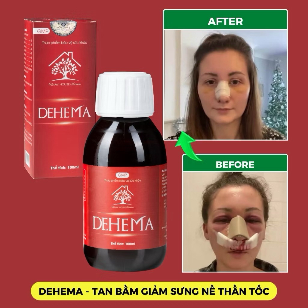 Dung Dịch Uống, Thực Phẩm Bảo Vệ Sức Khỏe Dehema 100ml Hỗ Trợ Giảm Sưng, Bầm Tím Nhanh Chóng - HERBA