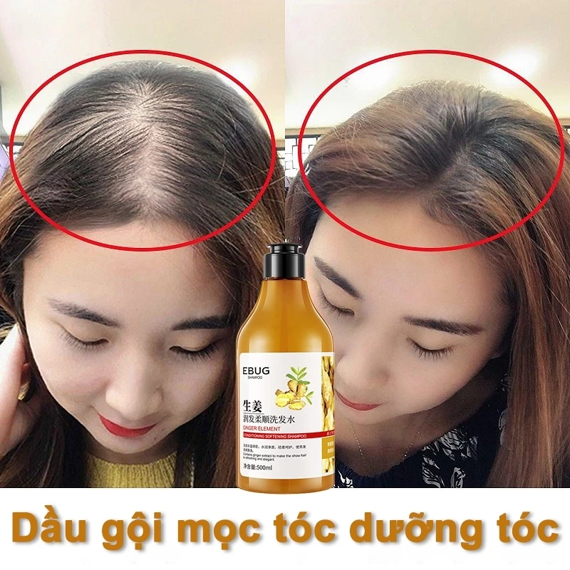 dầu gội chống rụng tóc và kích thích mọc tóc chính hãng 500ml giảm rụng tóc Mọc Tóc Nhanh kiểm soát dầu loại bỏ gàu