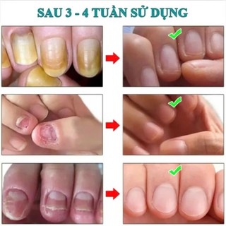 Serum dưỡng cứng móng