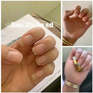 Serum dưỡng cứng móng