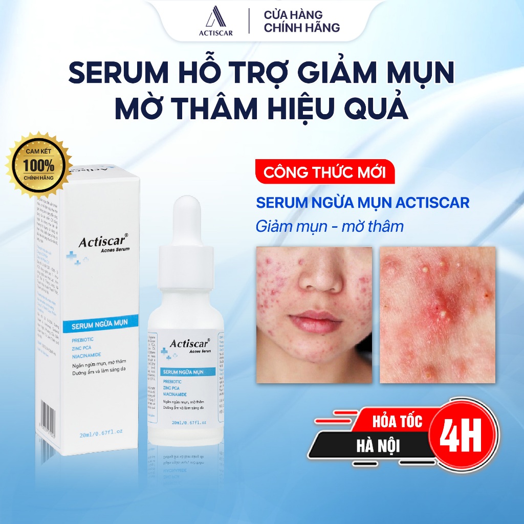 Serum chấm mụn chuyên sâu Actiscar Acnes Cream 20g Cải Thiện Tình Trạng mụn