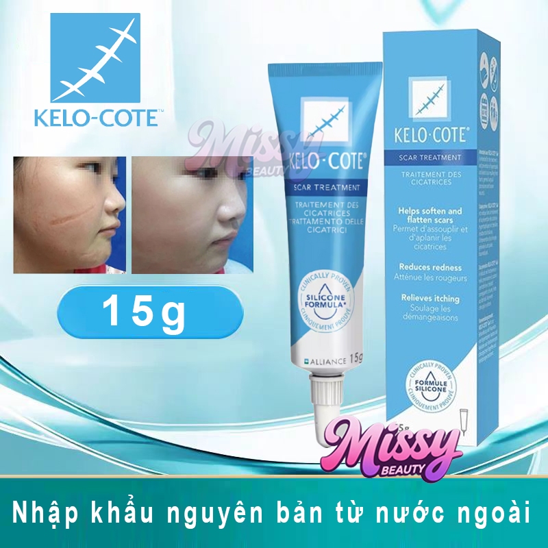 Kem giảm sẹo Kelo Cote giảm sẹo lồi, sẹo phẫu thuật, sẹo lâu năm Kelo-Cote Silicone Scar Gel 15g