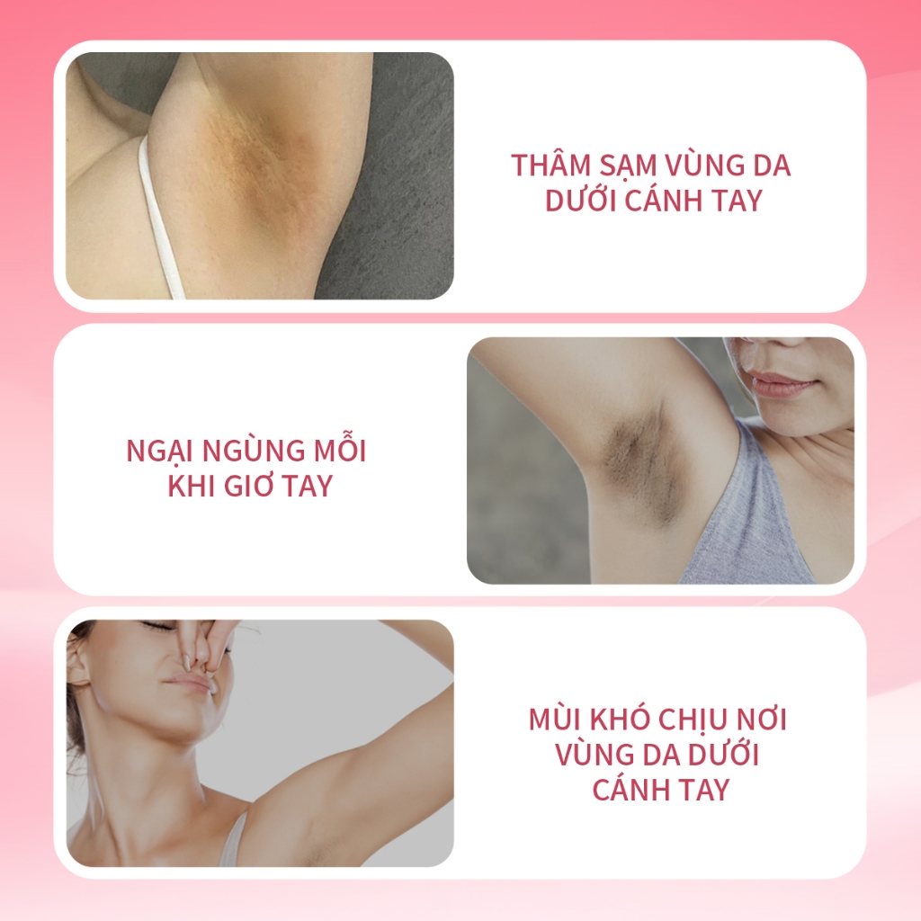 Kem dưỡng Hỗ trợ trắng sáng vùng da dưới cánh tay UILICY30g Khử Mùi Nách Trắng da Chống2% Niacinamide Symwhite377 Rose | BigBuy360 - bigbuy360.vn