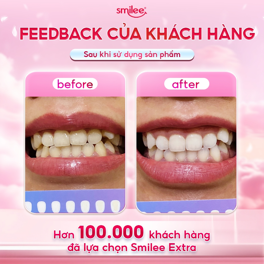 [GIÁ 797K TẠI LIVE SHOP] Trắng răng Smilee Extra, bộ kit làm trắng răng từ 2-6 tone tại nhà, đi kèm 3 bút gel, LIS | BigBuy360 - bigbuy360.vn