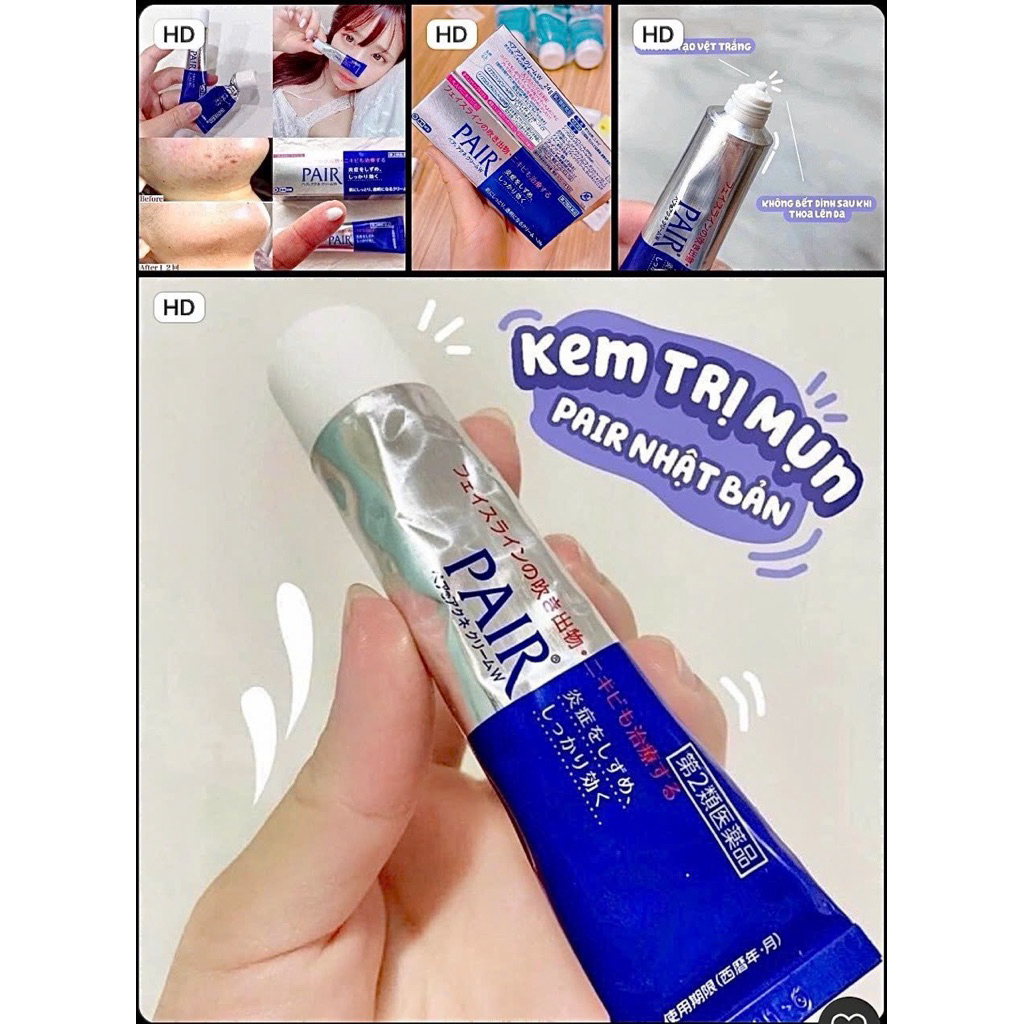 🌿❄ 𝐊𝐄𝐌 𝐓𝐑𝐈̣ 𝐌𝐔̣𝐍 𝐏𝐀𝐈𝐑 𝐍𝐇𝐀̣̂𝐓 𝐁𝐀̉𝐍 𝐒𝐈𝐄̂𝐔 𝐓𝐇𝐀̂̀𝐍 𝐓𝐇𝐀́𝐍𝐇 ❄🌿