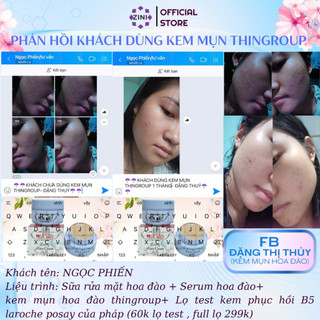 Combo Tiết Kiệm 5 Kem Mụn Hoa Anh Đào Sạch Mụn Mờ Thâm Sáng Da