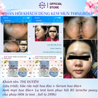 Combo Tiết Kiệm 5 Kem Mụn Hoa Anh Đào Sạch Mụn Mờ Thâm Sáng Da