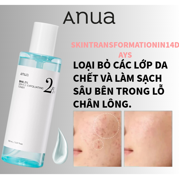 Toner Tẩy Da Chết ANUA BHA 2% 150ml - Nước Hoa Hồng Axit Salicylic, Giảm Mụn, Se Khít Lỗ Chân Lông, 