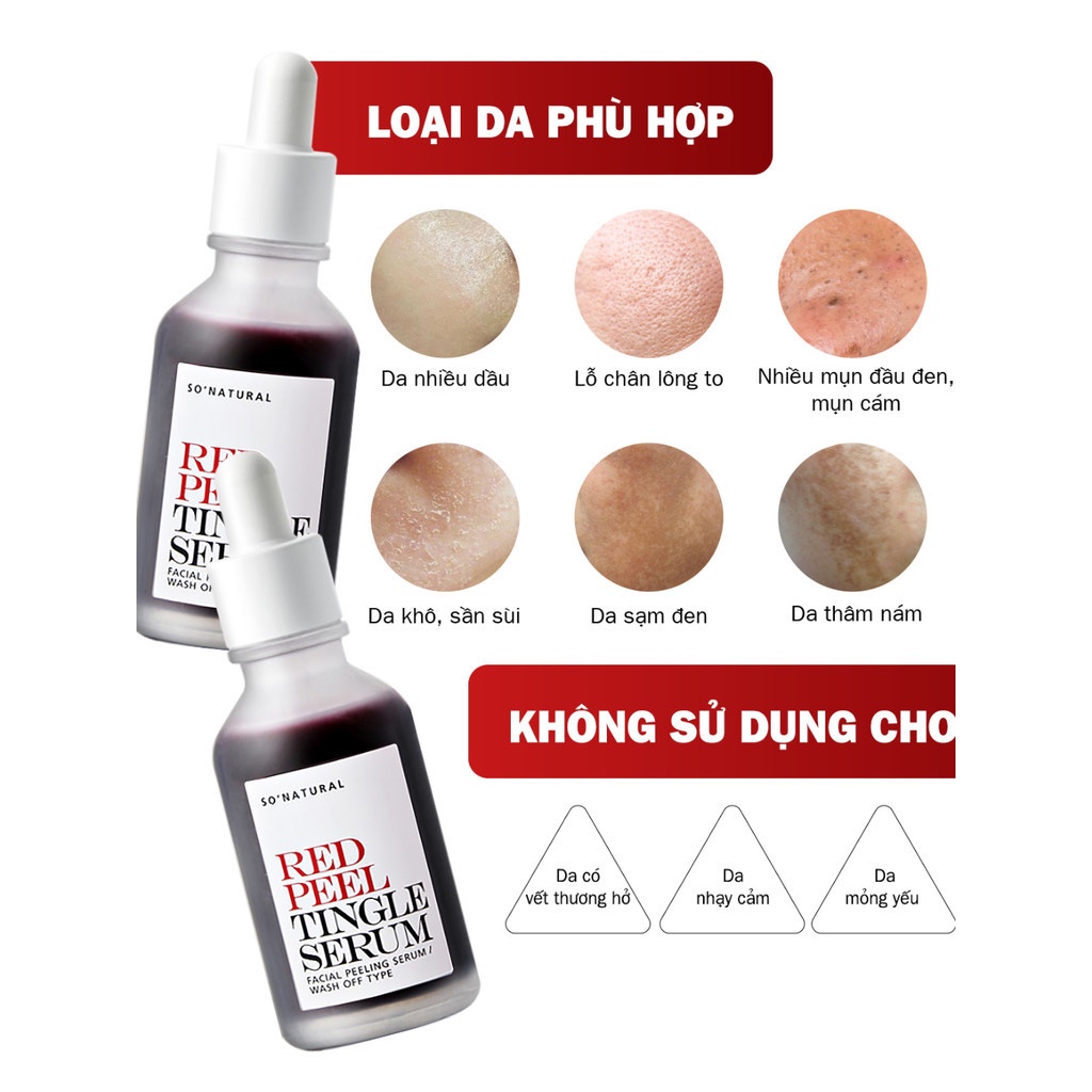 [GREAT x SO NATURAL][35ML] Serum Tinh Chất Red Peel So Natural - Peel Da Lành Tính, Đào Thải Tế Bào Chết & Làm Sáng | BigBuy360 - bigbuy360.vn