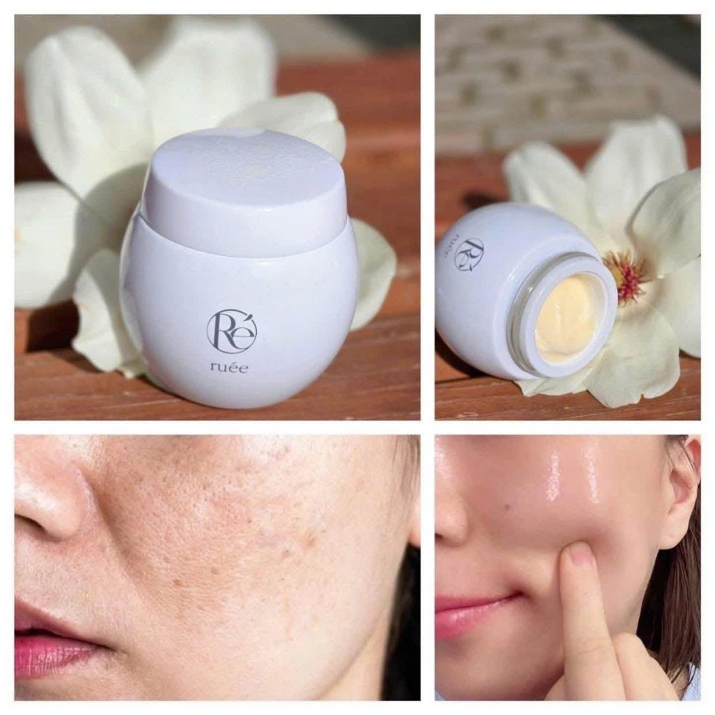 Kem Dưỡng Ruee Brightening Cream – Dưỡng Ẩm, Hỗ Trợ Làm Sáng Và Chăm Sóc Da Xỉn Màu