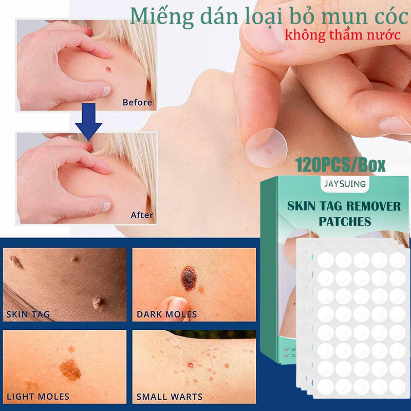 Dán mụn cóc dễ sử dụng -tẩy nốt ruồi xoá nốt ruồi tẩy nốt ruồi trên mặt Warts Remover