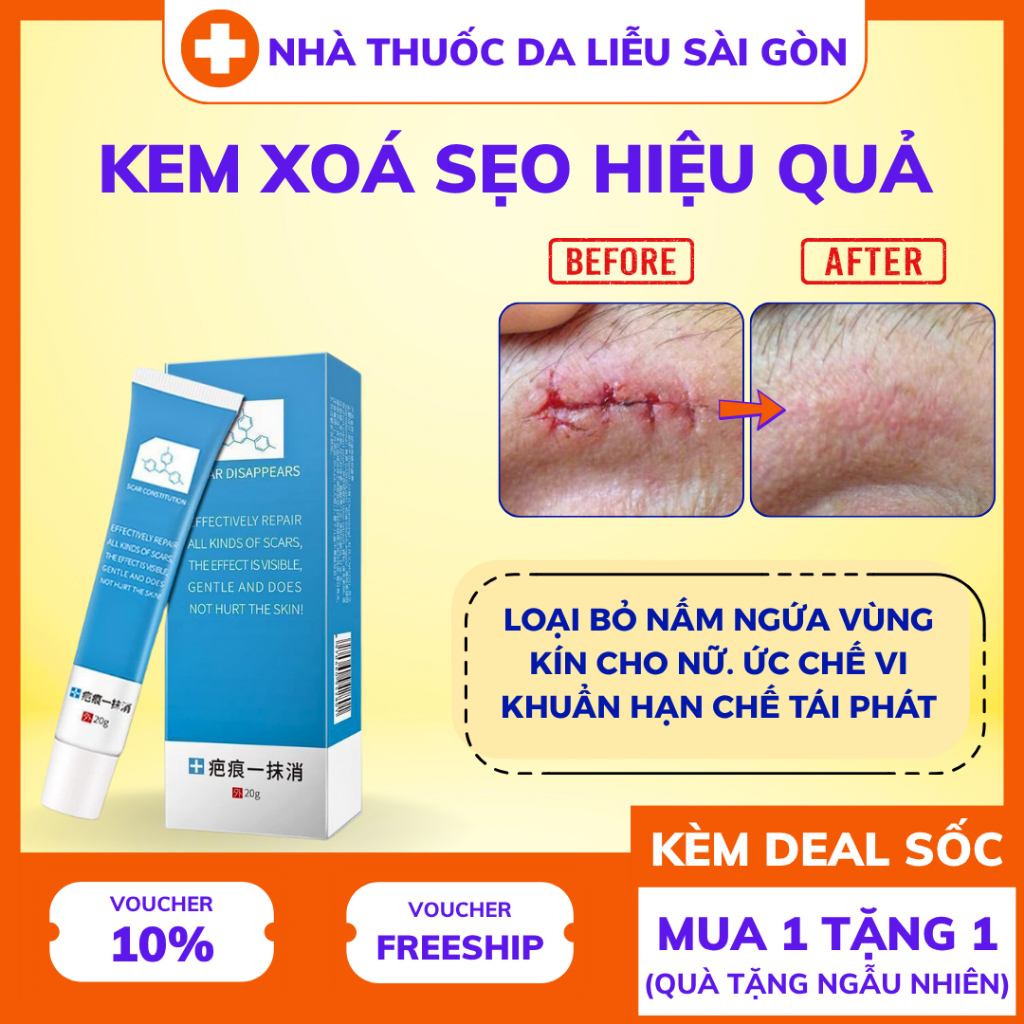 Kem xóa sẹo nhanh chóng, vết sẹo trầy xước, vết bỏng, vết thương sau phẫu thuật, vết rạn da tăng