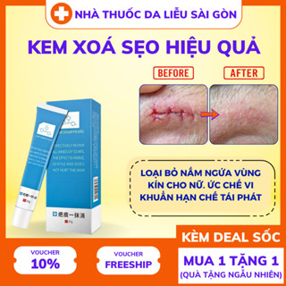 Kem xóa sẹo nhanh chóng, vết sẹo trầy xước, vết bỏng, vết thương sau phẫu thuật, vết rạn da tăng
