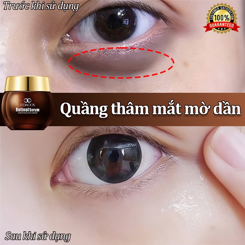 Kem dưỡng mắt làm mịn da LYDIMOON Retinol Essence 35g: Giảm quầng thâm, loại bỏ bọng mắt và chống lã