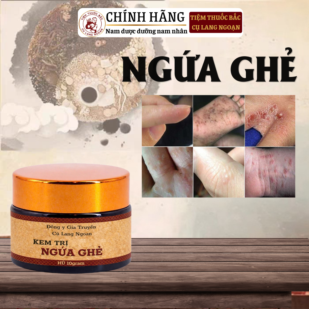 Kem bôi ngứa ghẻ cụ Lang Ngoạn loại bỏ nấm ngứa, zona, hắc lào, nấm chân tay, nấm theo mùa, vieem da cơ địa hũ 10gram