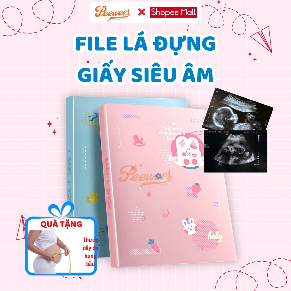 File đựng giấy siêu âm 30 lá PEEWEES hỗ trợ theo dõi, lưu trữ hình ảnh tài liệu khám thai một cách khoa học cho mẹ bầu