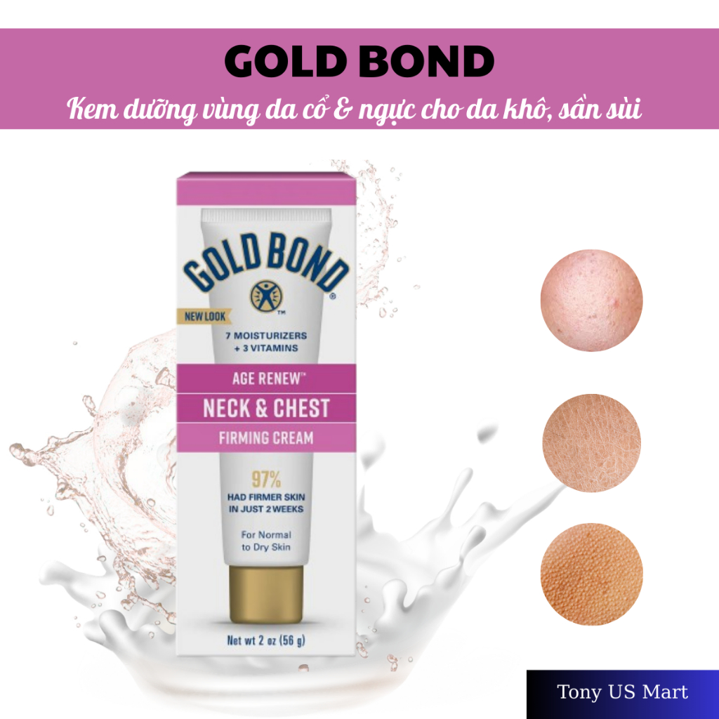 Gold Bond Age Renew 56g – Kem Dưỡng Vùng Cổ Ngực, Cải Thiện Độ Săn Chắc – Tony US Mart