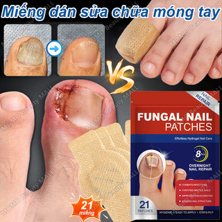Miếng dán sửa chữa móng tay Miếng dán nấm móng chân móng mọc ngược chăm sóc móng tay Màu Xám onychomycosis Chống nấm